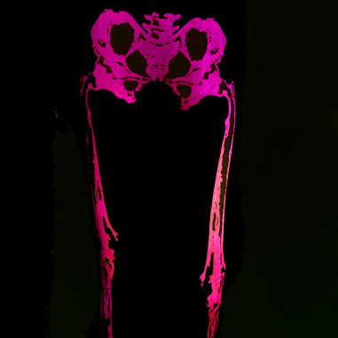 Neon Skeleton Leggings